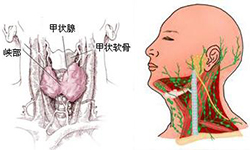 甲状腺炎