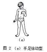 小儿脑瘫