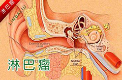 淋巴瘤