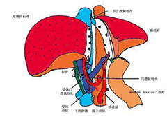 肝移植