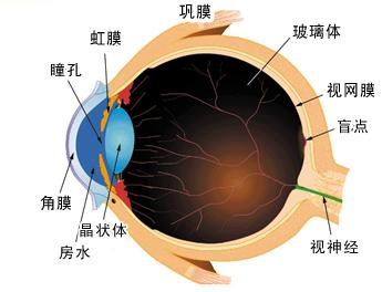 白内障